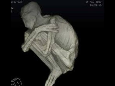 Amazing 3 Fingered Mummy discovered In Nazca Peru!!!